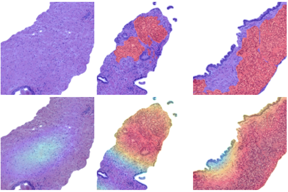 Artificial Intelligence in Medicine